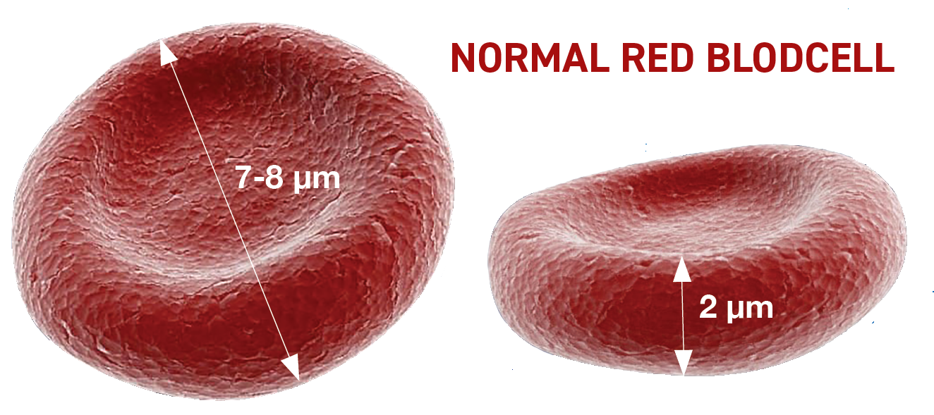 Representasjon av en normal rød blodcelle